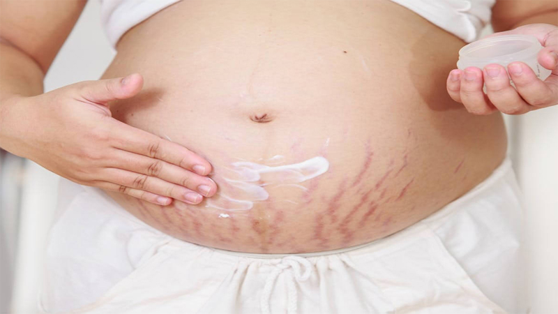 Pregnant women should apply sunscreen to avoid UV rays